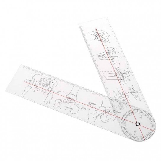 Гониометр для измерения подвижности суставов