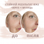 Кинезио тейп для лица Kindmax Face Tape 2,5см х 10м